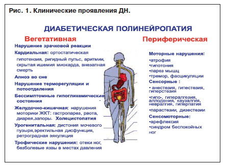 Алкогольная нейропатия карта вызова