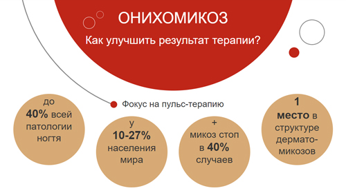 Ирунин