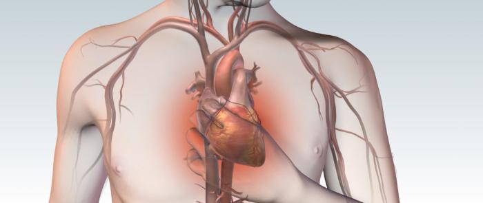 Клинические рекомендации Стабильная ишемическая болезнь сердца