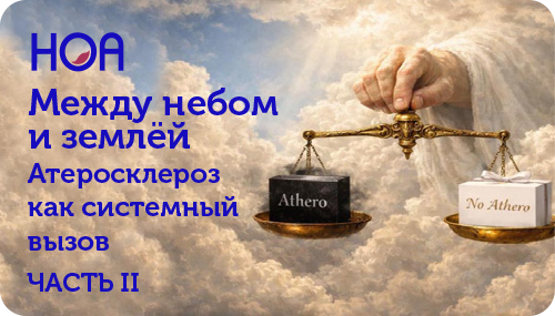 НОА Между небом ... Часть II