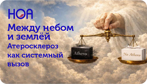 НОА Между небом ....