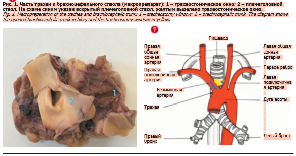 Screenshot_1.png Screenshot_1.png