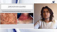 Распознавание инфекционных осложнений при заболевании кожи различной этиологии
